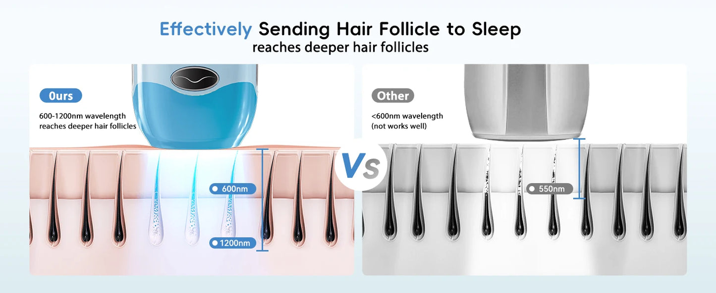 IPL Laser Hair Removal – 22J, Unlimited Flashes, 5.2cm² Window